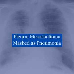 Pleural Mesothelioma Masked as Pneumonia