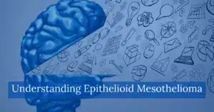 Understanding Epithelioid Mesothelioma