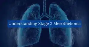 Understanding Stage 2 Mesothelioma