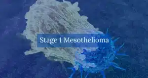 Stage 1 Mesothelioma