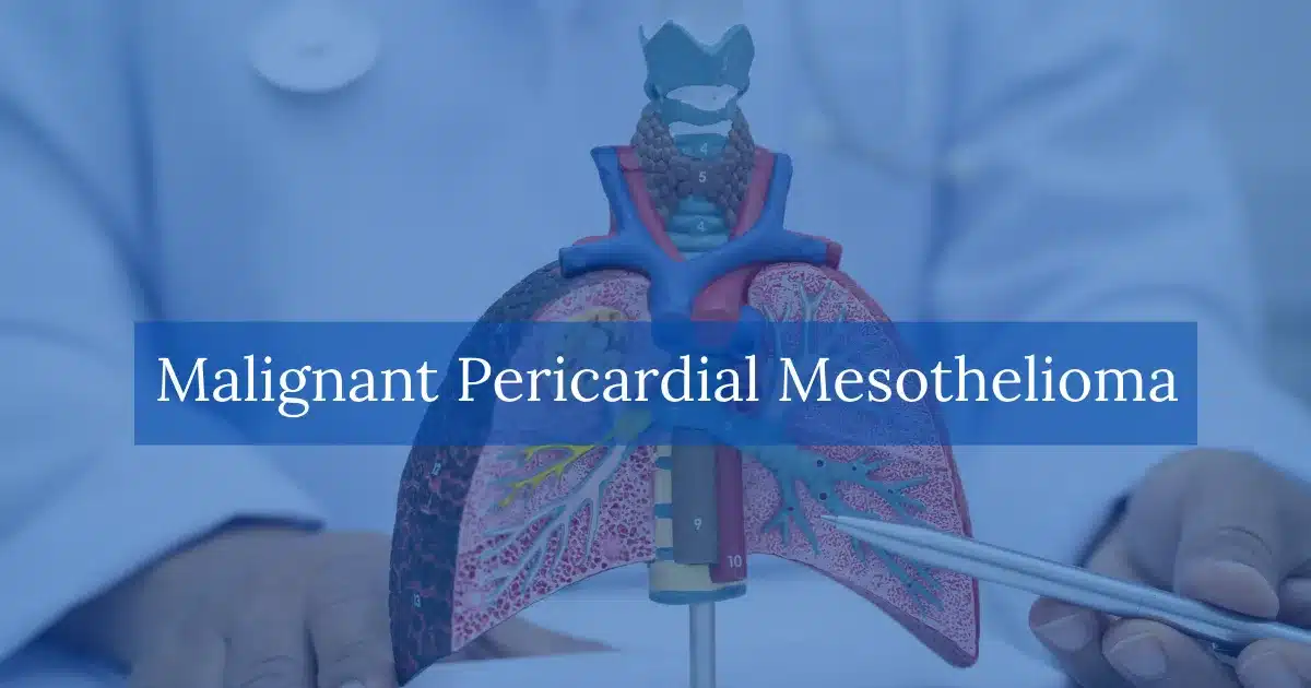 Malignant Pericardial Mesothelioma