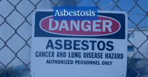 Asbestosis