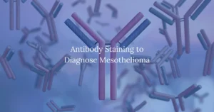 Antibody Staining to Diagnose Mesothelioma
