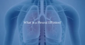 What is a Pleural Effusion?