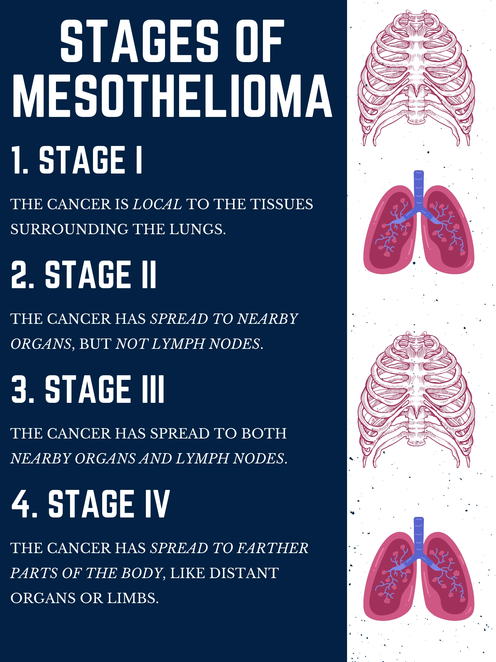 San Bernardino Mesothelioma Lawyer Vimeo