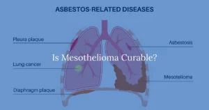 Is Mesothelioma Curable?