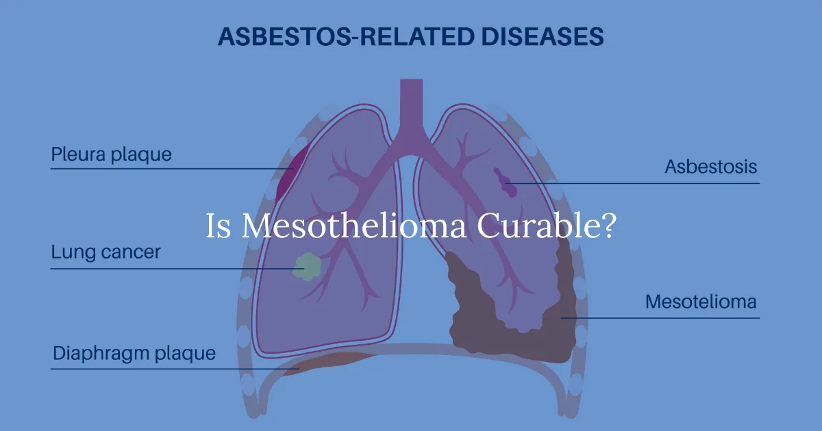 Is Mesothelioma Curable?