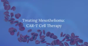 Treating Mesothelioma: CAR-T Cell Therapy