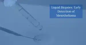 Liquid Biopsies: Early Detection of Mesothelioma